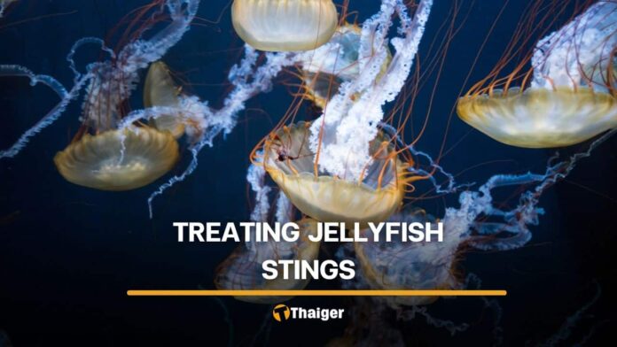 Essential Guide to Treating Jellyfish Stings in Thailand